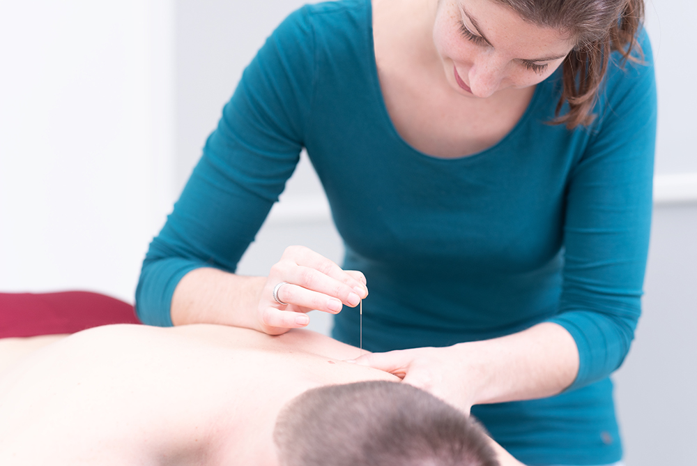 DRY NEEDLING